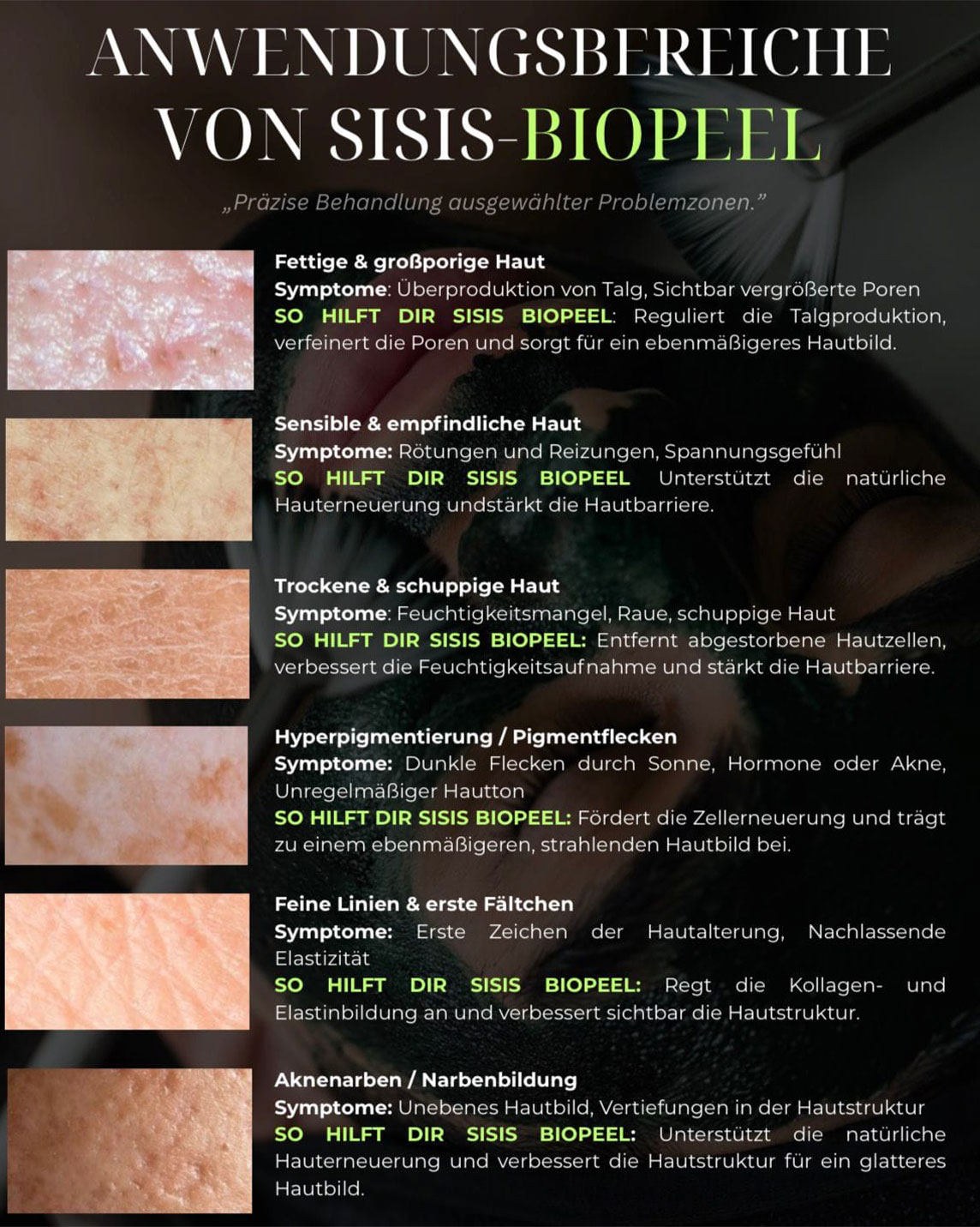 Biopeel_sis4